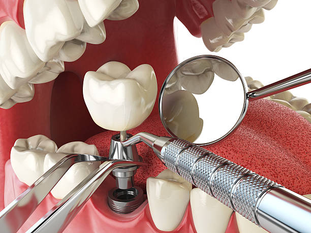 Best Pediatric Emergency Dentist in Mountain View, AR