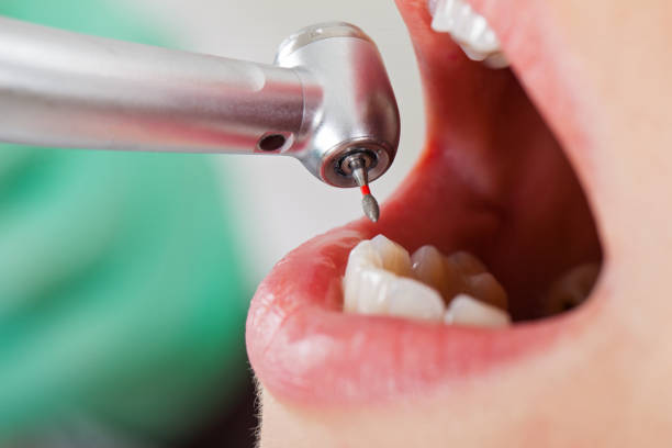 Best Emergency Broken Tooth Repair in Mountain View, AR